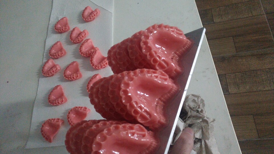 iDenture amplia inserção de próteses dentárias digitais no mercado nacional