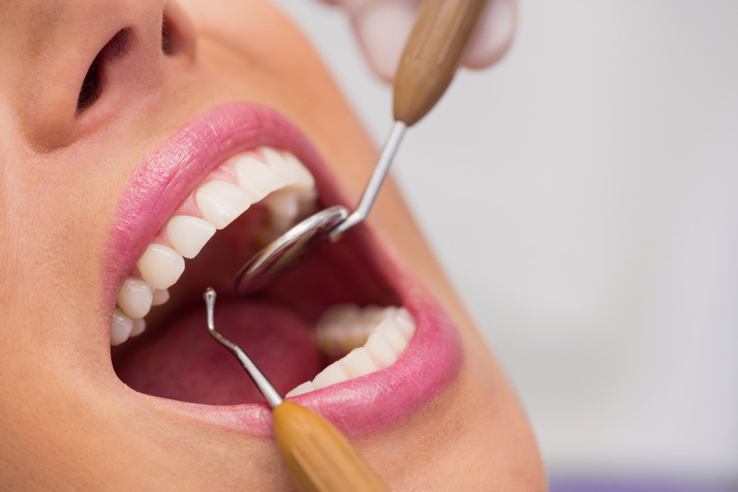 Julho Neon: Hapvida +Odonto oferece saúde bucal como pilar do bem-estar integral todos os dias do ano